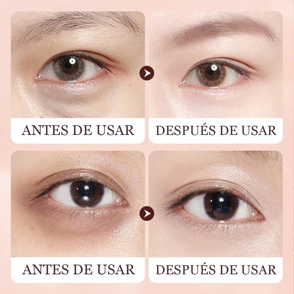 Crema para Ojos Sadoer (Con Veneno de Abeja) - ¡40%OFF PROMOCIÓN LIMITADA + Envío Gratis!
